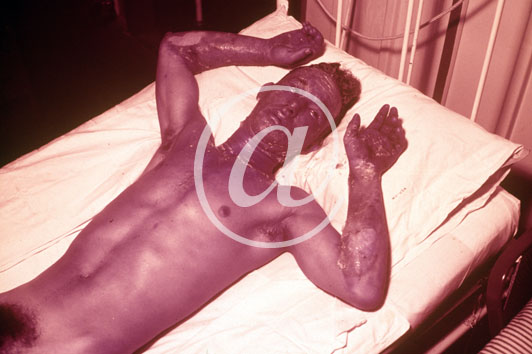 inconnu() Seconde guerre mondiale US Navy en couleurs - Srie 80-GK- : Un jeune homme nu dans un lit d